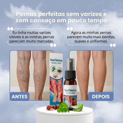 VARIVEINS™ - VOLTA A TER PERNAS LEVES NESTE VERÃO